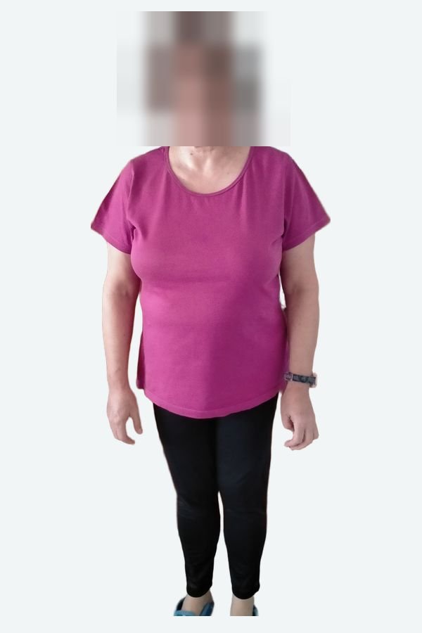 Beatriz antes, de frente, con la cara pixelada
